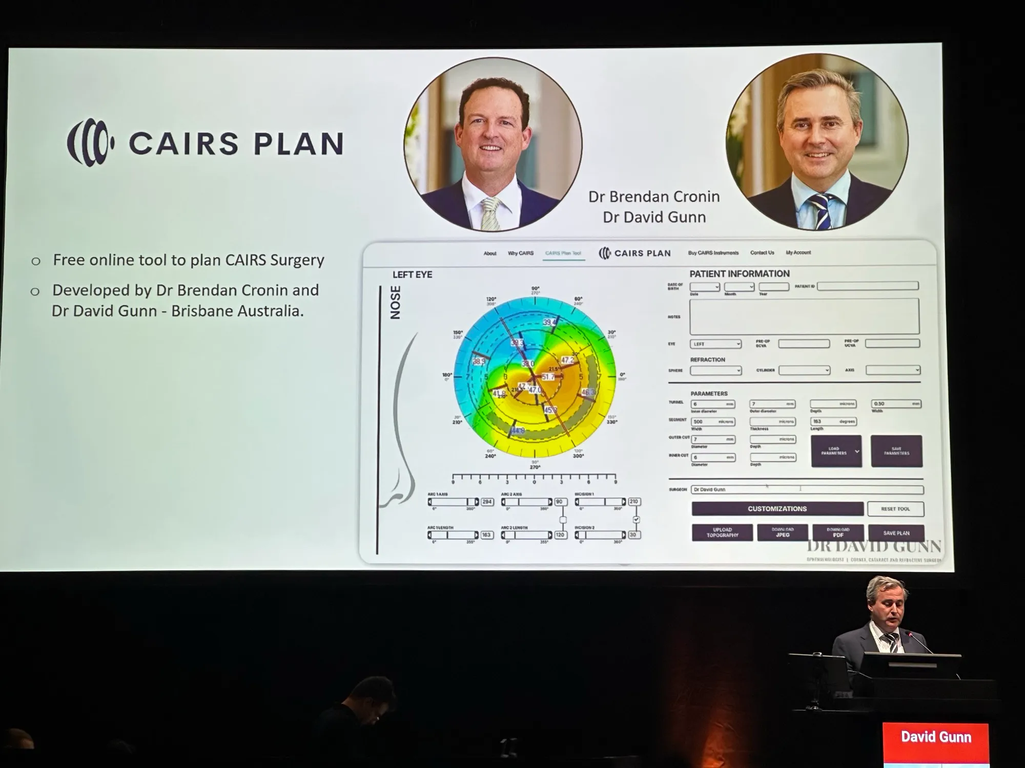 The CAIRSPlan surgical planning slide presented at ESCRS Copenhagen 2025, crediting Dr Brendan Cronin and Dr David Gunn.