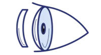 CORNEAL SURGERY