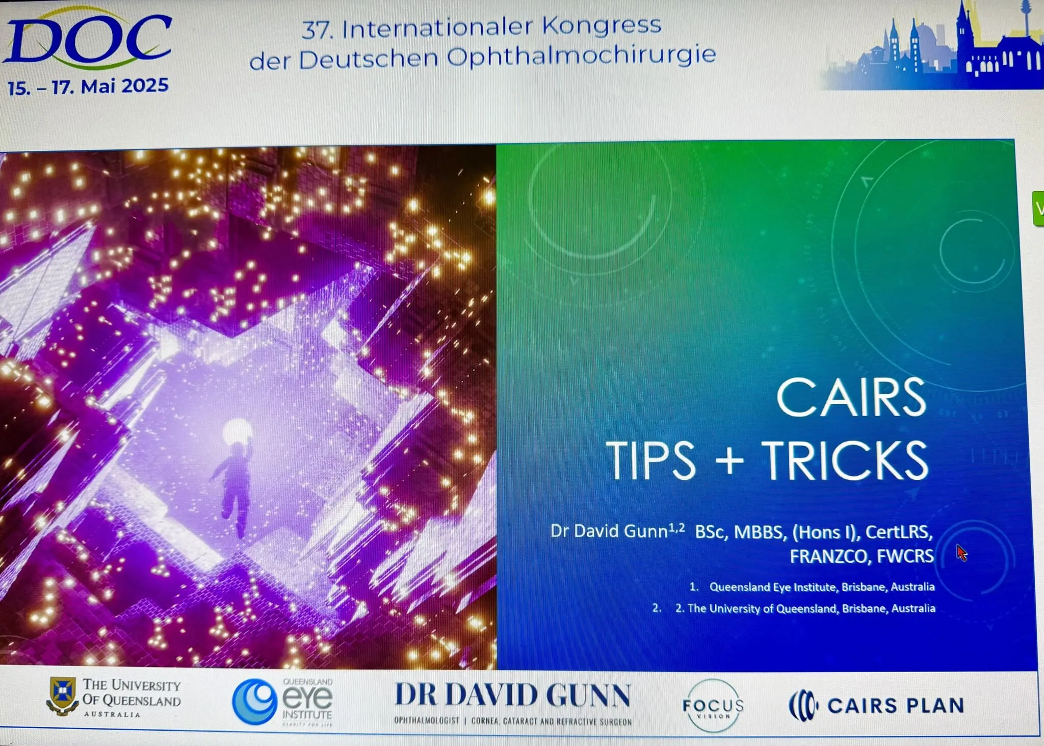 Dr David Gunn's CAIRS Tips + Tricks presentation slide at the German Ophthalmic Society meeting DOC May 2025.