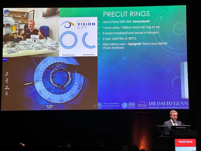 Dr David Gunn presenting the Precut Rings slide during the Transitioning to CAIRS session at ESCRS Copenhagen 2025.