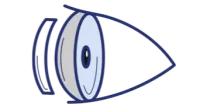 FUCH'S DYSTROPHY