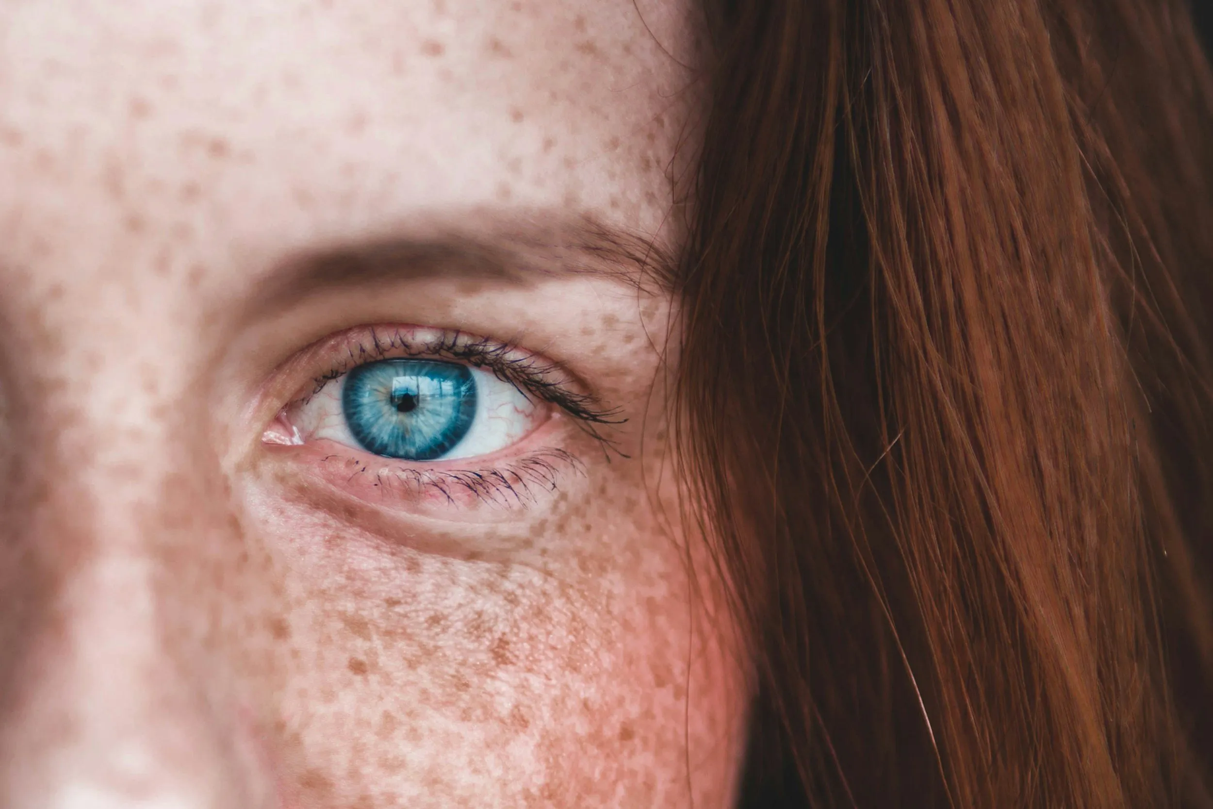 Close-up of a vibrant blue eye with freckled skin, symbolizing clear and healthy vision, a goal of cataract surgery.
