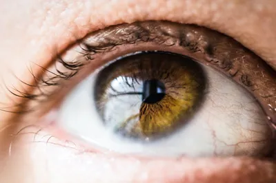 Macro shot of a human eye with hazel iris and pupil, symbolizing the cornea for Keratoconus treatment and CAIRS procedure.