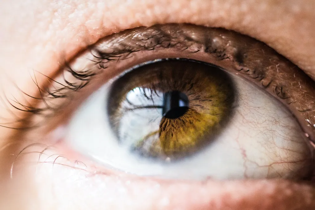 Macro shot of a human eye with hazel iris and pupil, symbolizing the cornea for Keratoconus treatment and CAIRS procedure.