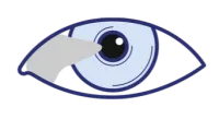 PTERYGIUM SURGERY